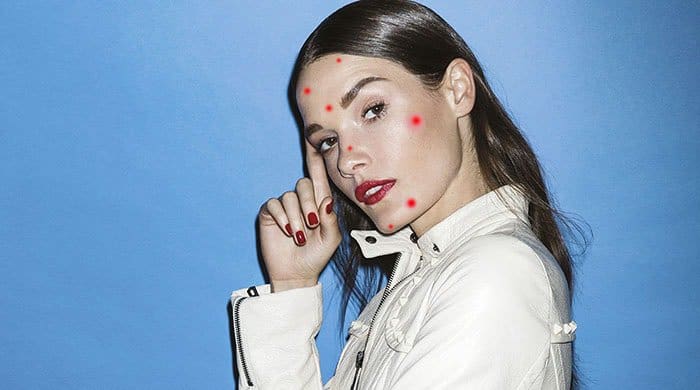 7 Struggles All Adult Women With Acne Understand