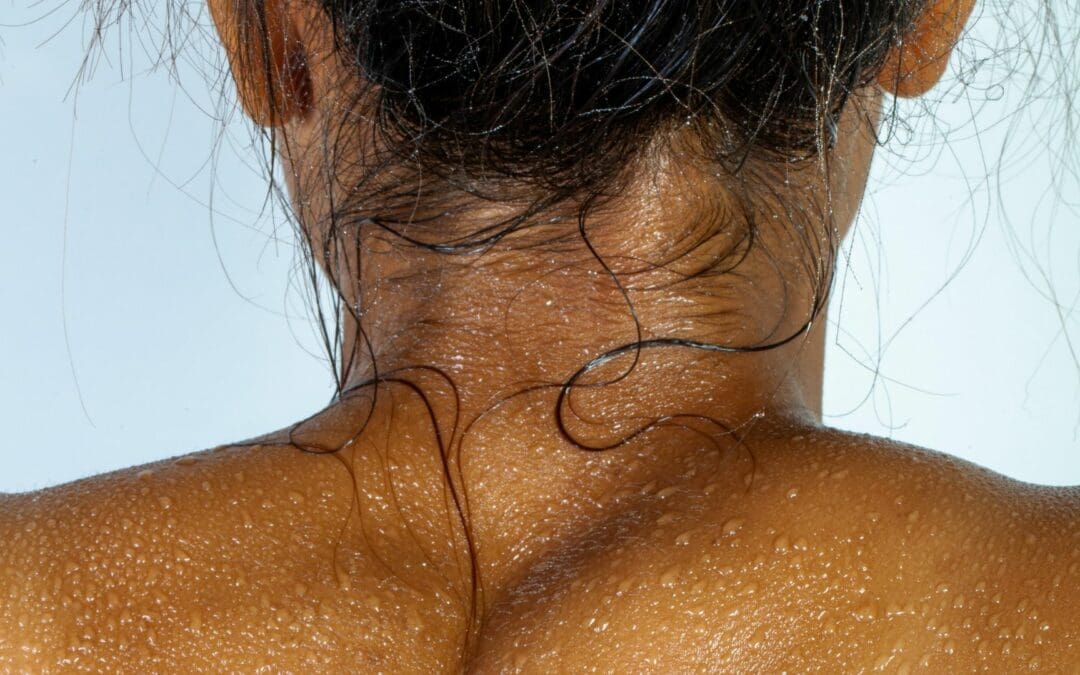 Skin And Workouts: 6 Gross Things That Happen To Your Skin While Exercising