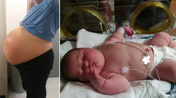 This Mom Is Sharing What It’s Like To Give Birth To A 6.1kg Baby!