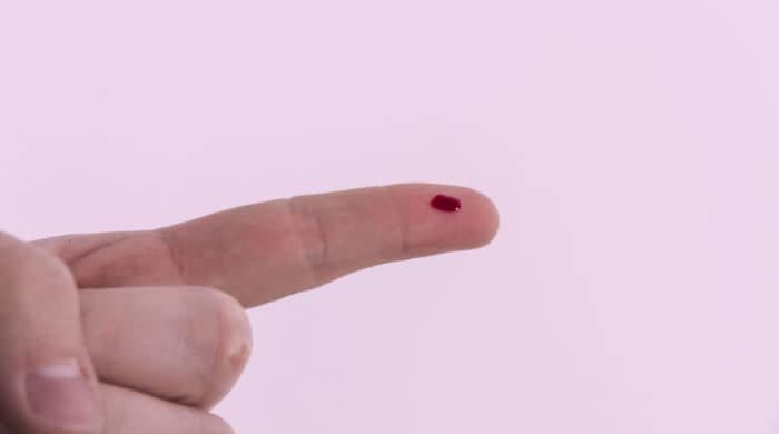 This Woman Literally Sweats Blood And Doctors Are Baffled By Her Condition