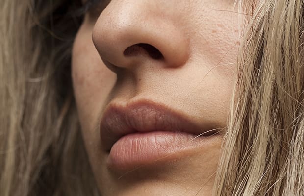 How To Get Rid Of A Pimple In Your Nose