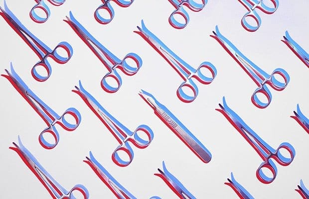 How To Deal With Loose Skin After Extreme Weight Loss