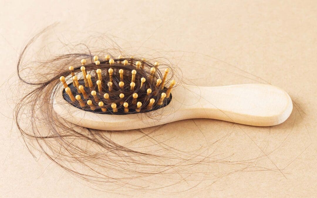 More And More Women Say They’ve Got Hair Loss From Using GLP-1s – Experts Explain Why